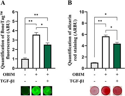 Legumain is a paracrine regulator of osteoblast differentiation and mediates the inhibitory effect of TGF-β1 on osteoblast maturation